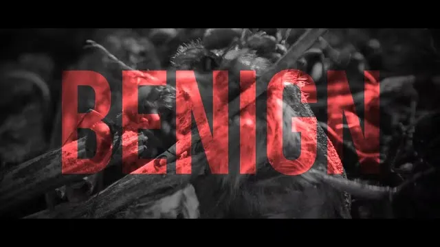 Scaphist - BENIGN ( Ft. DEVIN SHIDAKER OF THE ACACIA STRAIN)